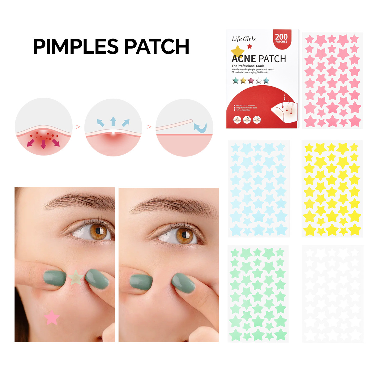 Life Girl Star Acne Paste Pro-Pel Skin Breathable Skin Acne Limpie Acne suave Acne Cross-Border Herramientas de belleza