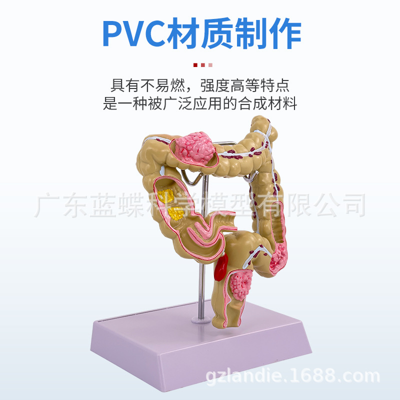 ��ѧ��������󳦲���ģ�ͳ�θֱ���̴�������ʳ��������᳦����