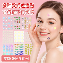 �羳���u��ɫˮ�z�w�����N�������w��ӡ�[�θ��x����Դ�^�S��͸��