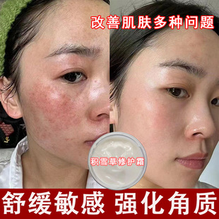 Centella Asiatica Repair Cream to Remove Redness, Moisturize and Thicken Barrier, Soothe Sensitive Skin, Hormone Face Redness Repair Cream