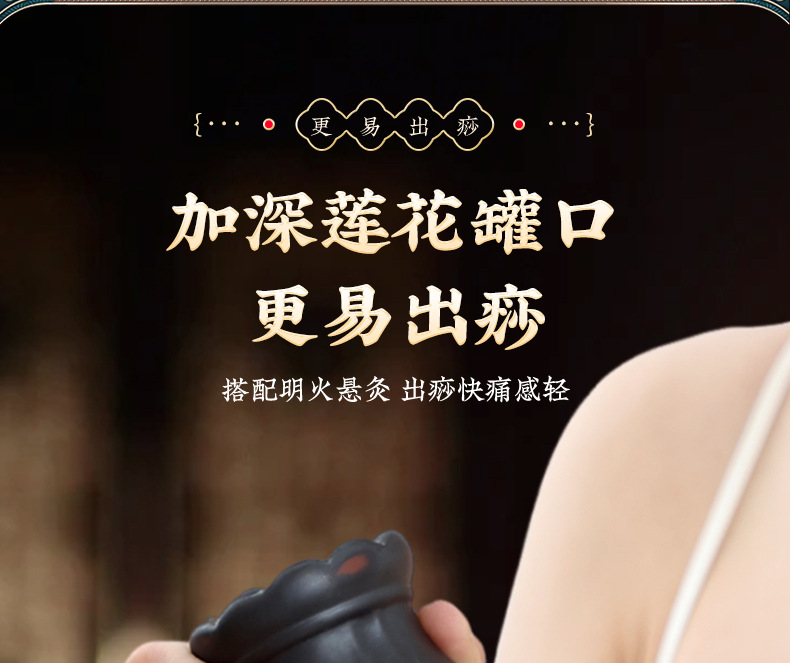 Bian Stone Fire Dragon Cupping Jar Gua Sha Massage Moxibustion Jar with Lotus Rim Heat-Resistant Home Use 365g quality and texture