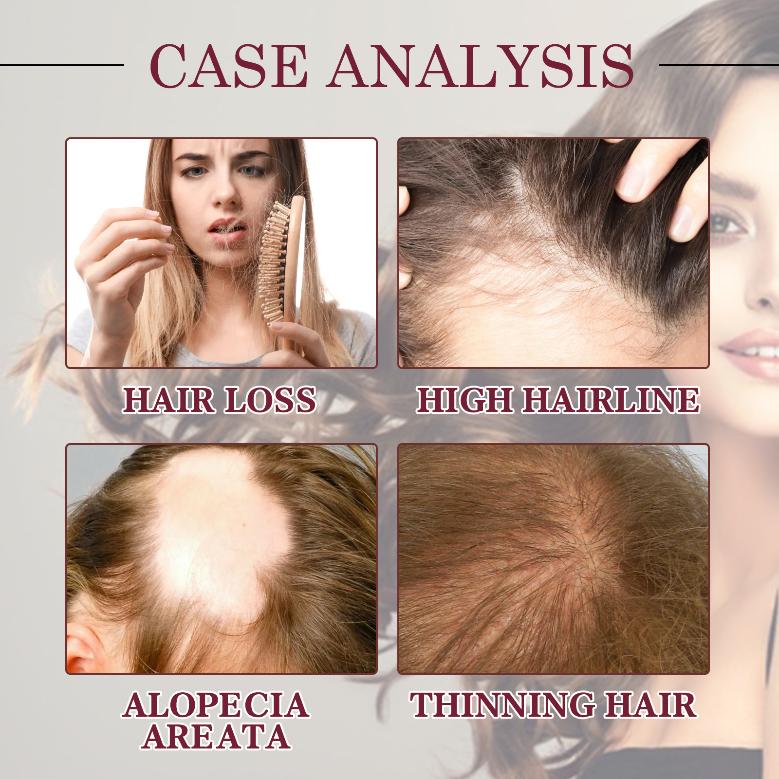 OUHOE ätherisches Zwiebelöl dichtes, starkes, festes, feuchtigkeitsspendendes Haarpflegespray_voghion.com