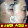 377vc Broken Black Frost Desalination Freckle Chloasma Melanin Rejuvenation Yellowish Beauty Herbal Face cream