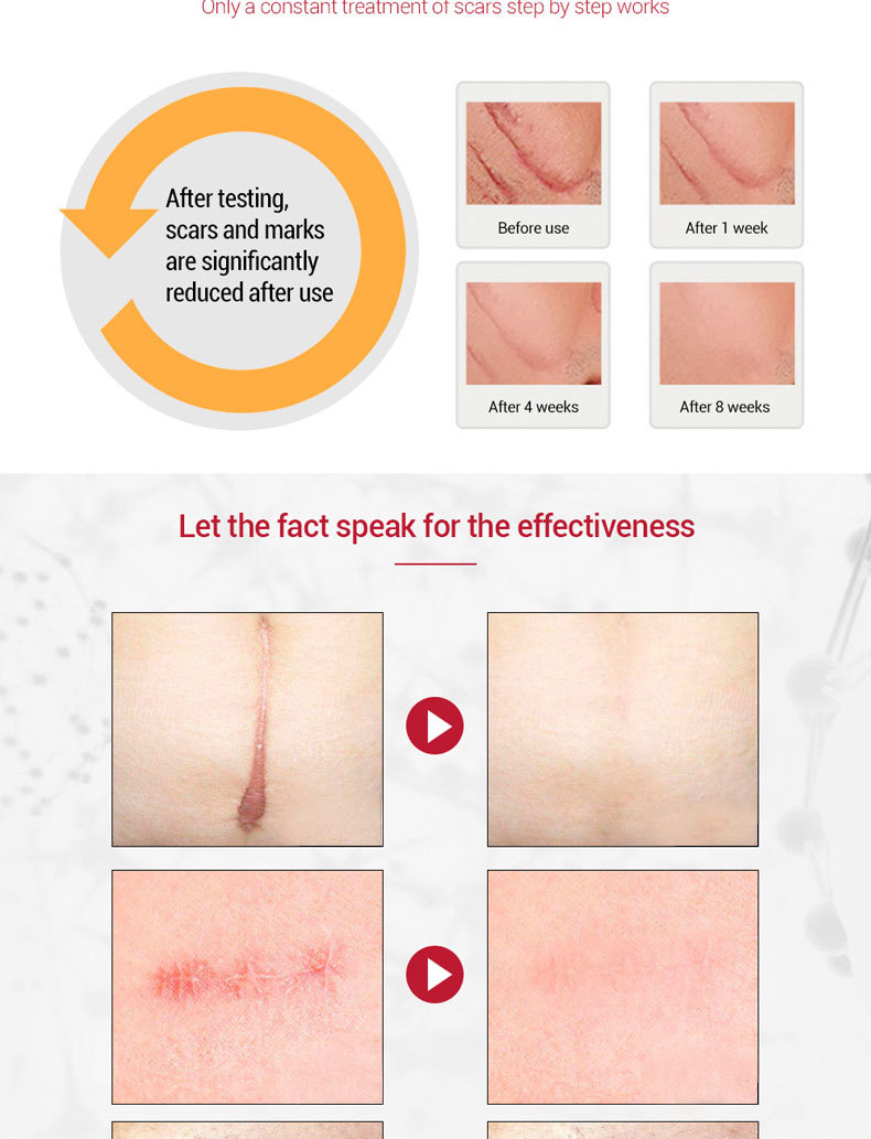Scar Cream Image 5