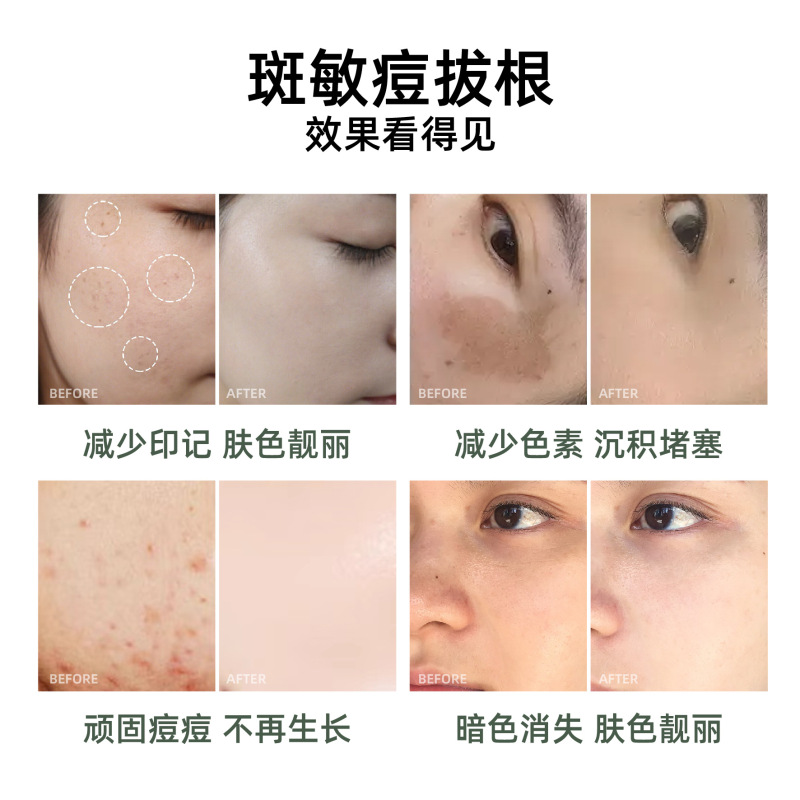 本草は肌を養って毒を抜いて、顔をきれいにして天然痘の美容院の専用の顔をケアして顔を明るくします。|undefined