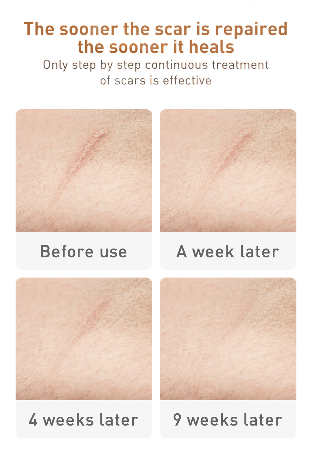 reparação da pele acne manchas acnetreatment cuidados
