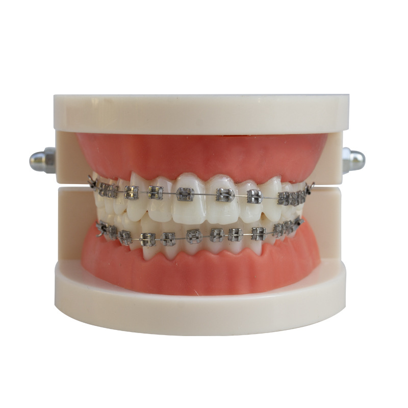 Modelo de corrección dental ortodoncia dental molde de metal de cerámica soporte de contraste arco modelo de visualización de alambre