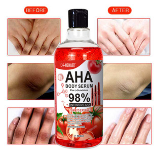 �羳���Ѿ��AҺ�غ;o���̝����o���w�沿�aˮ�����A¶ԭҺ���l