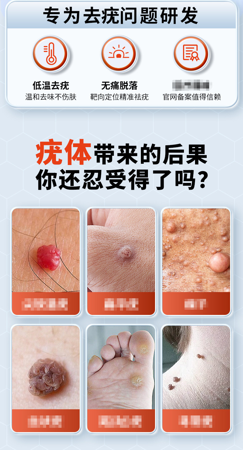 南京同仁堂祛疣膏扁平尤面部去尖锐疣肉刺疣丝状疣乳膏抑菌液药膏-阿里巴巴