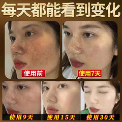 美白淡斑祛斑淡斑修復套霜去黃去黑淡化色斑雀斑黃褐斑補水保濕