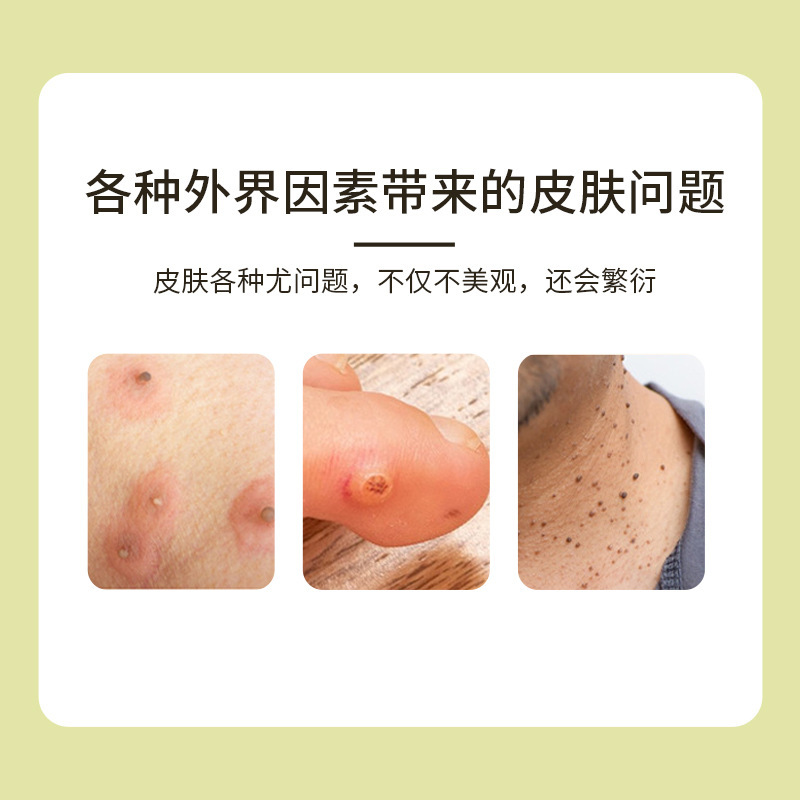 淮南堂ヨウフピングスキンクリーム抗菌クリームは鶏の皮膚を除去し、体のニキビを除去します Ai Products Biotechnology 
|undefined