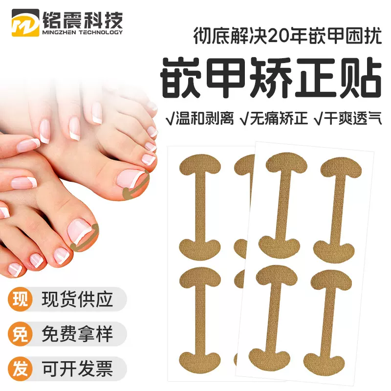 正甲贴矫正指甲纠正贴物理拉伸指甲贴厂家甲沟贴片矫正脚趾嵌甲贴