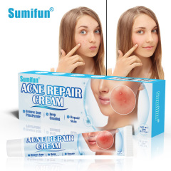 Sumifun Amazon Cross-border Medicine Cream for Acne and Pimples, Whitening Cream, Supplier Wholesale