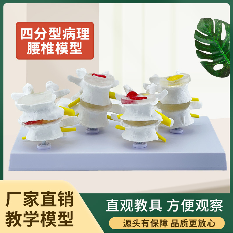 �Ľ׶β�����׵ģ�� ��������ģ�� ���ι��� ��̬������׵ģ��