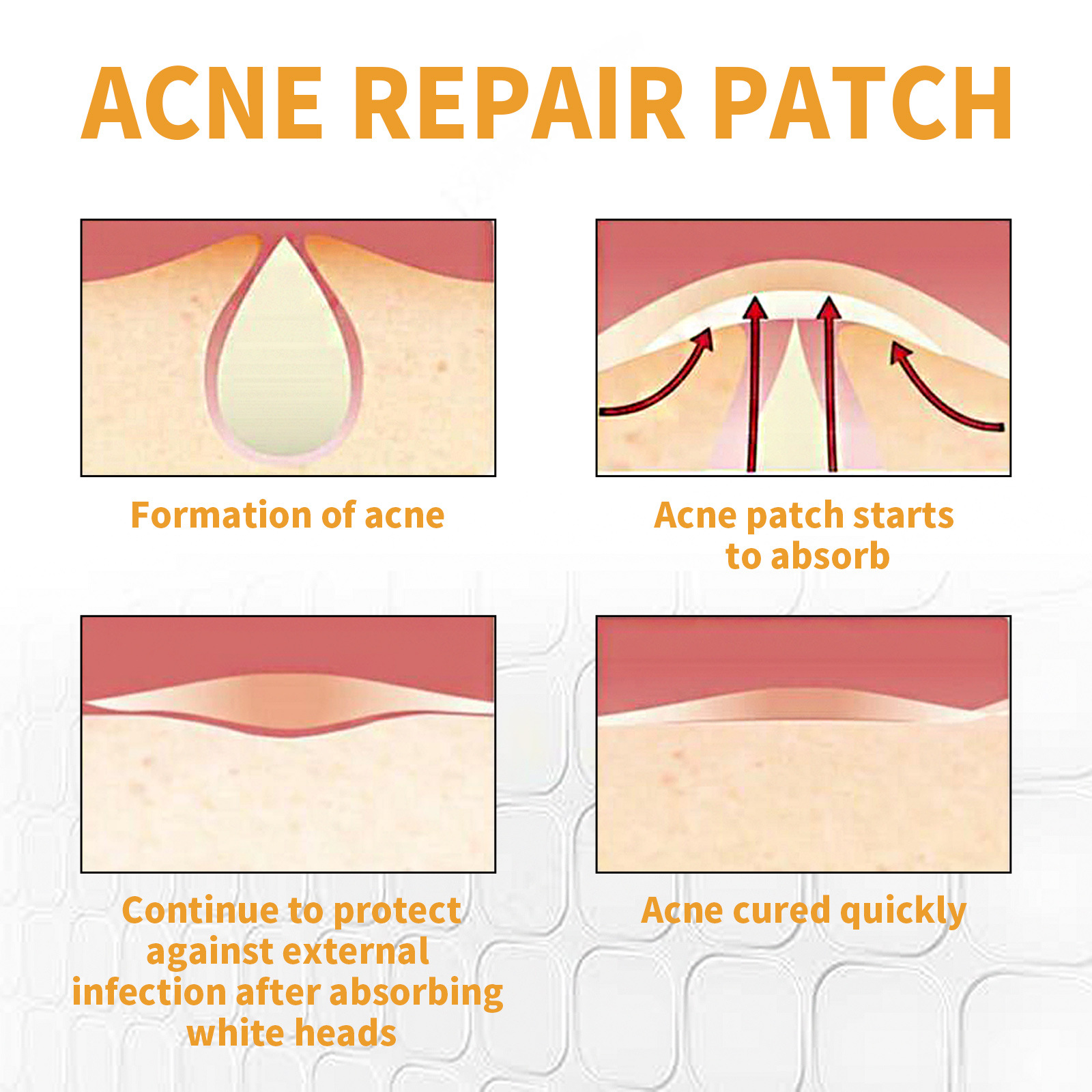 Jaysuing Chin Gel Patch de nettoyage portable pour enlever et imprimer l'acné_voghion.com