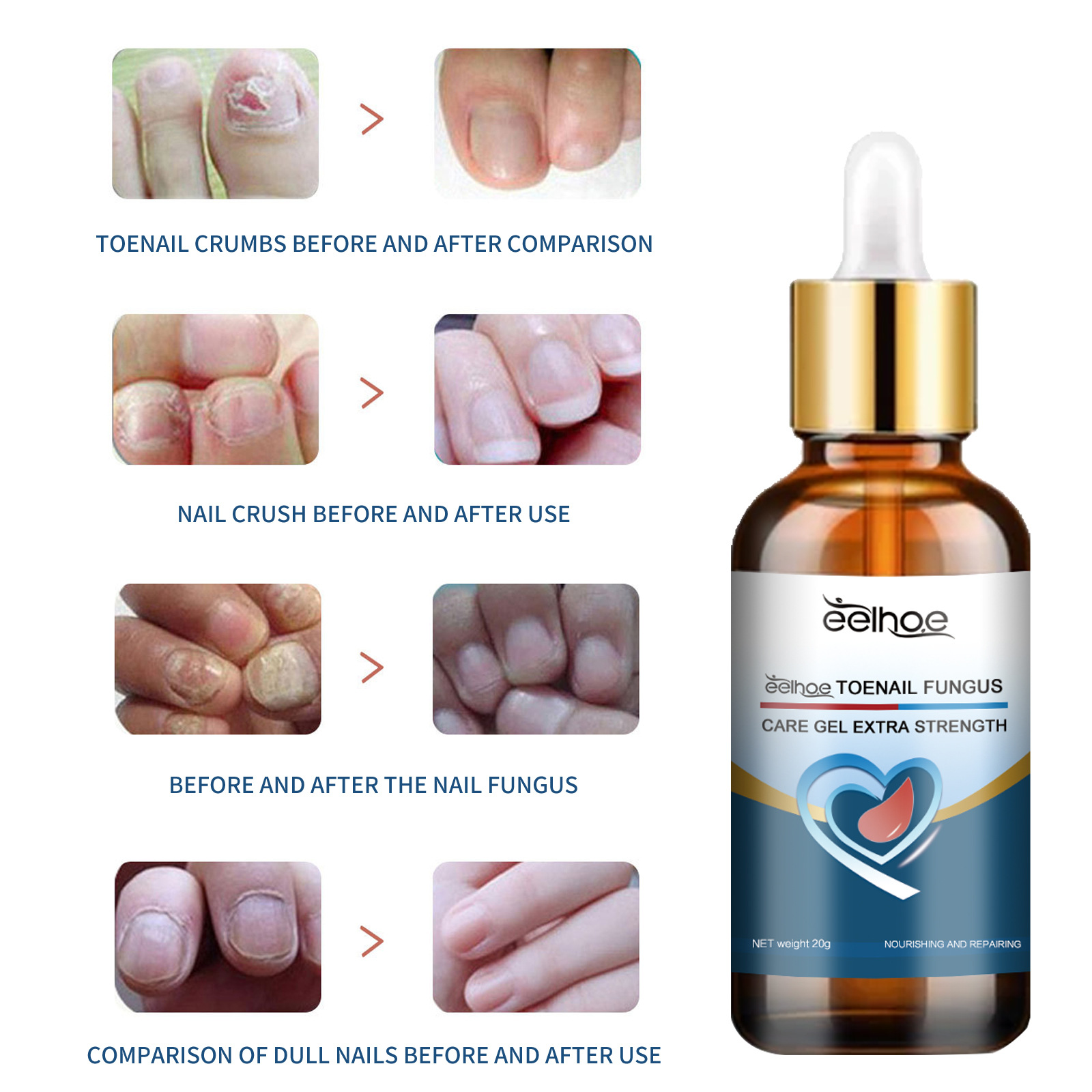 EELHOE gel Repair Hand, Foot, Grey Groin, Soft Nail, Moisturizing and Shining Nail Care_voghion.com