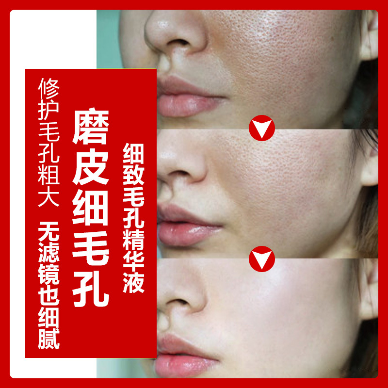 毛孔细致精华液修护痘痘粉刺细致毛孔细嫩肌肤补水保湿 oem加工