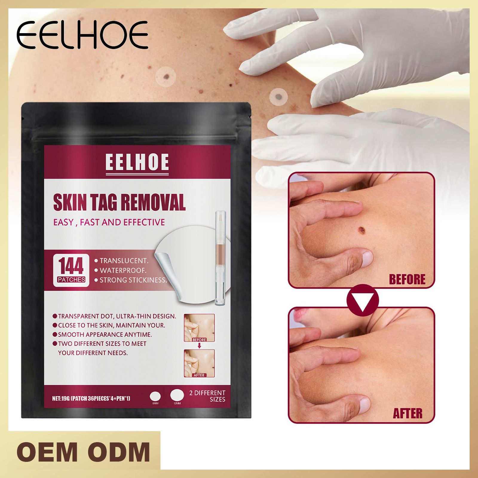 EELHOE wart suit skin repair smooth skin mole removal corns Thorn wart meat grain sharp wart filiform wart