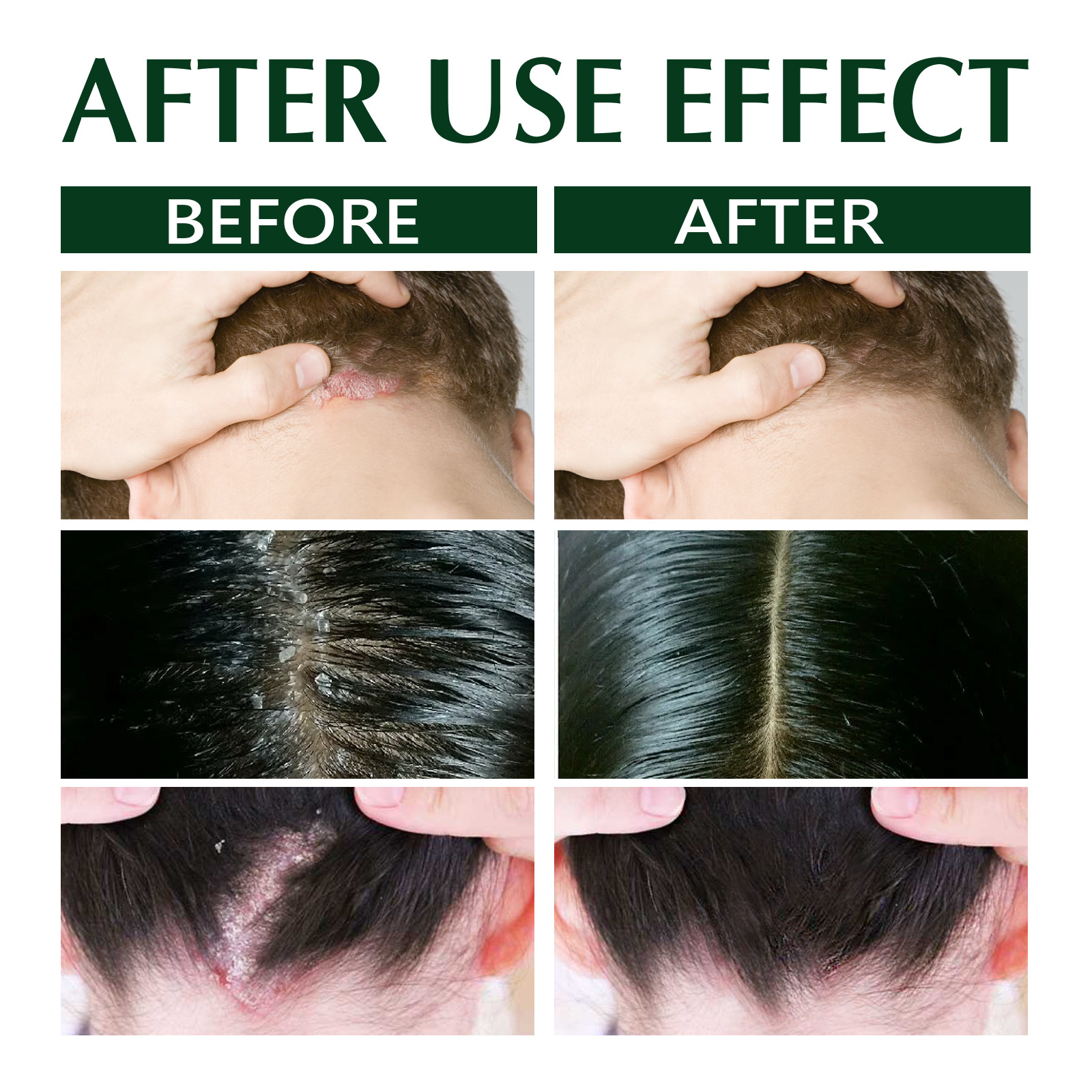 South Moon 頭蘚止癢洗髮水 頭髮控油頭皮清潔去屑止控癢清爽修護