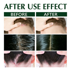 South Moon 頭蘚止癢洗髮水 頭髮控油頭皮清潔去屑止控癢清爽修護