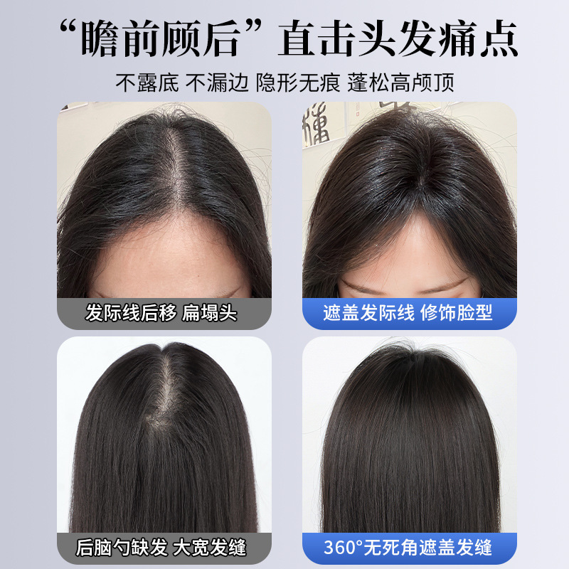 许昌批发高颅顶假发片女头顶蓬松神器增发量自然轻薄遮白发真发刘|undefined