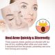 The Same Style of Ready-Made Transparent Universal Acne Star Acne Patch Invisible Acne Removal Waterproof and Sweat-Proof Youth Acne Patch