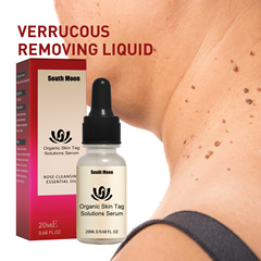 South Moon Acne Removing Liquid Deep Cleansing Skin Wart Lightening Dark Spot Repairing Smooth Skin Care Liquid