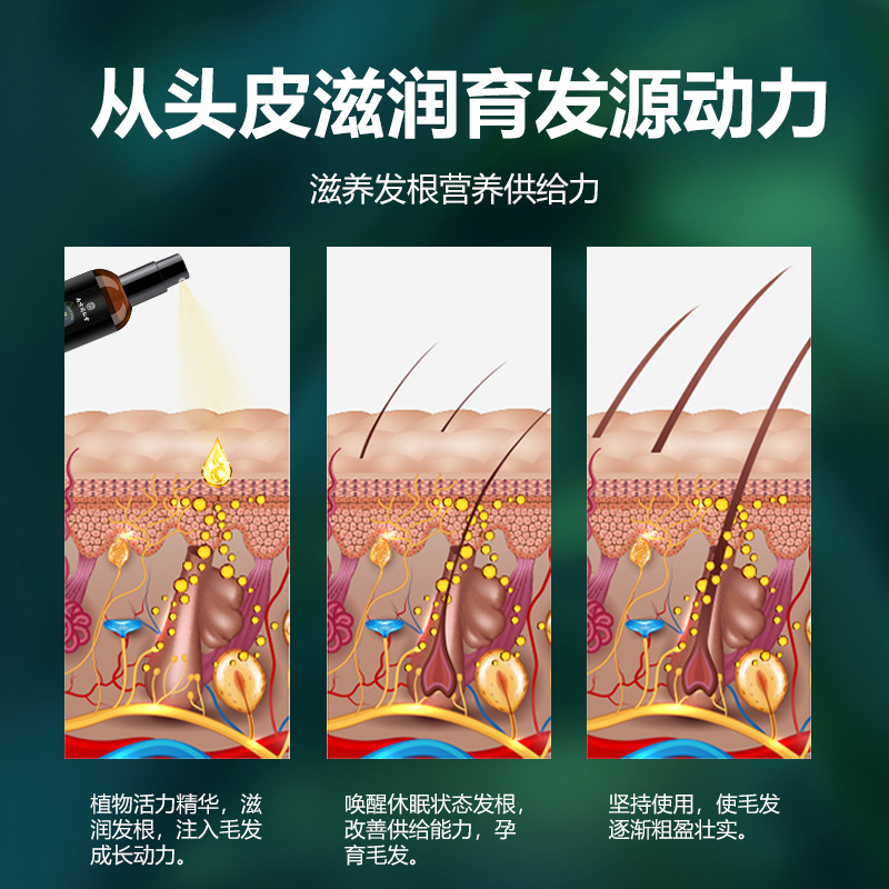 南京同仁堂 脱毛防止 白髪染め育毛液 育毛栄養液 頭皮ケアエッセンス|undefined