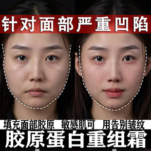 �zԭ�������˪ȥ���o��˪�������y�����o�±��񿹰���˪�ؽM˪