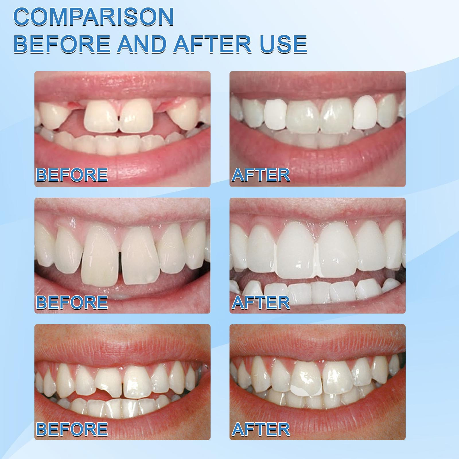 Jaysuing shapeable gum, film television, makeup, denture modification, temporary cavities, broken teeth, and filling of_voghion.com
