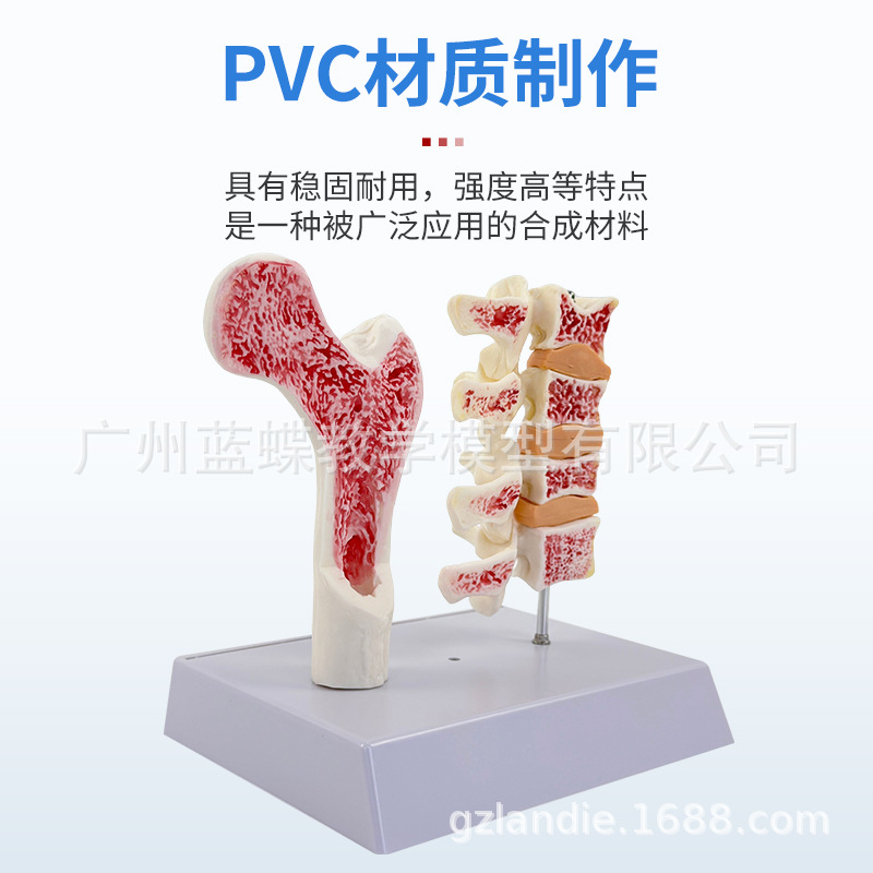 ����ɹǹ������ɽ���ģ���ȹǽ����� ��������걾 ������׵ģ��