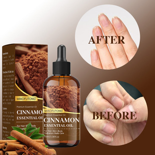 ���u�羳Cinnamon����Ч�����沿�̝��������w��Ħ�^�lָ���o��