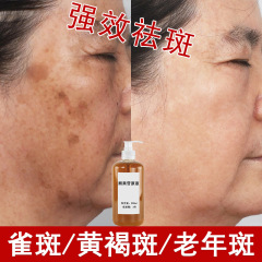 シミを薄くし、肝斑、そばかす、シミを除去する高濃度アルブチン原液、美容室卸売シミ溶解液