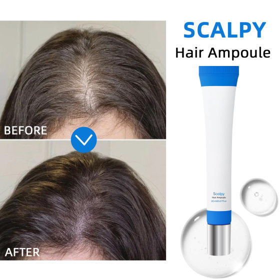 Cross-border non-standard hair growth strong hair root dense hair solid hair to promote hair growth liquid to activate hair follicle anti-desquamation hair growth essence
