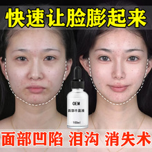 �沿�Sӯ���AҺ�S̫�Ѩ���Ę�a�����a���zԭ����ȥ���o�����Һ