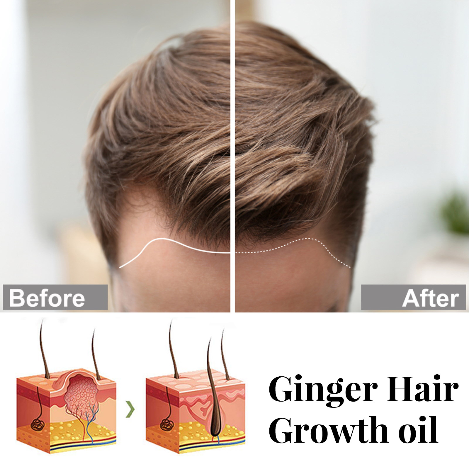 EELHOE Essential Oil Long Dense Soft Silk Ginger Essenz Haarspülung_voghion.com