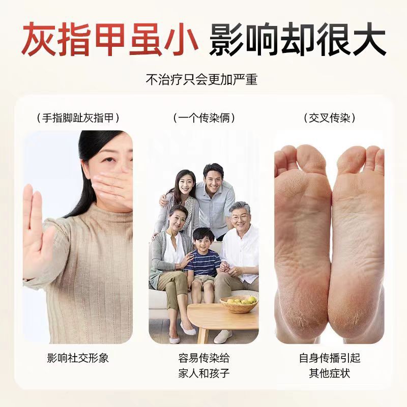 【公式正規品】Yaguo Ning YP型医療用解熱ジェルはベストセラーで、痕跡のない卸売をサポートしています|undefined