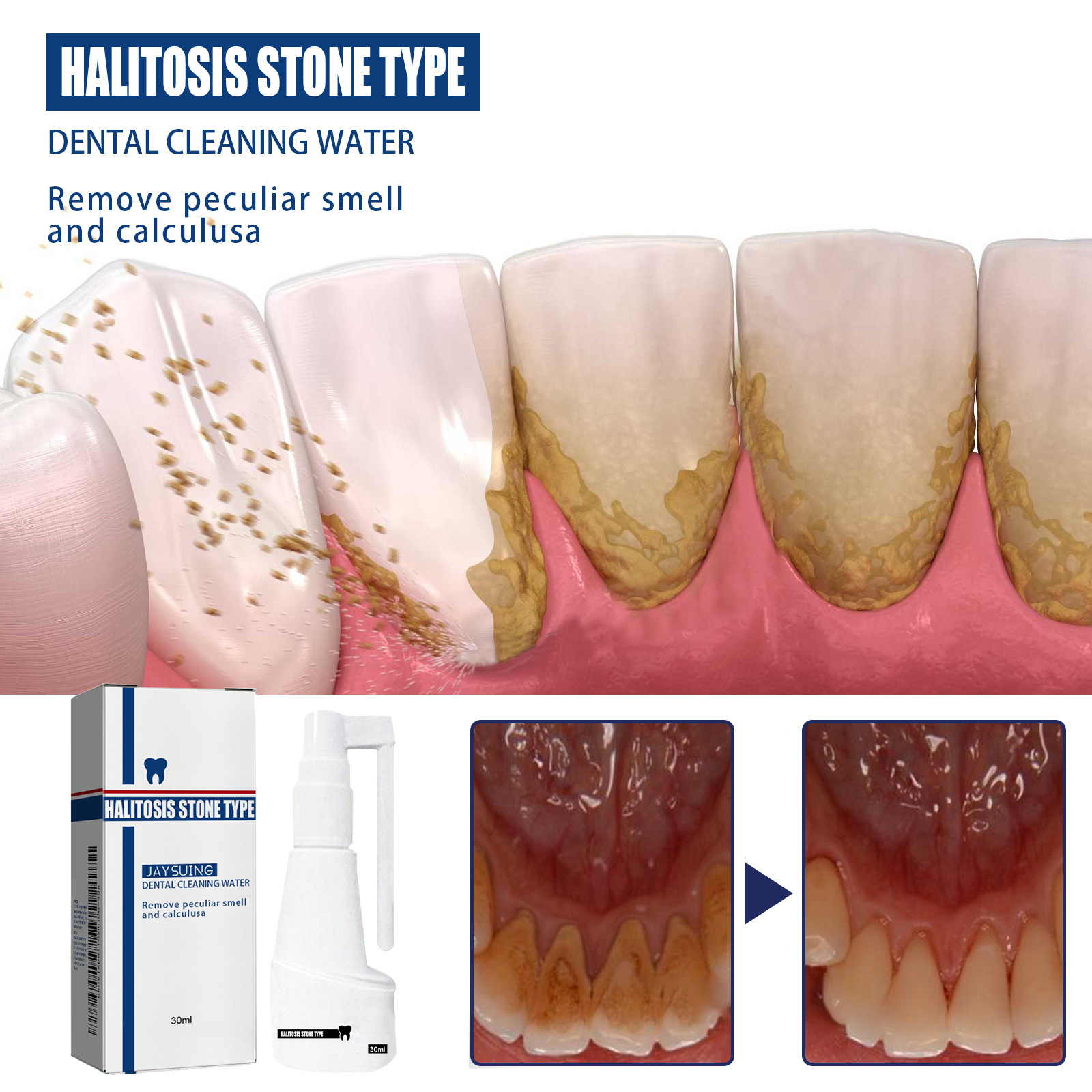 Jaysuing牙石溶解口腔噴霧 持久留香味溶解遬牙結石口臭牙垢