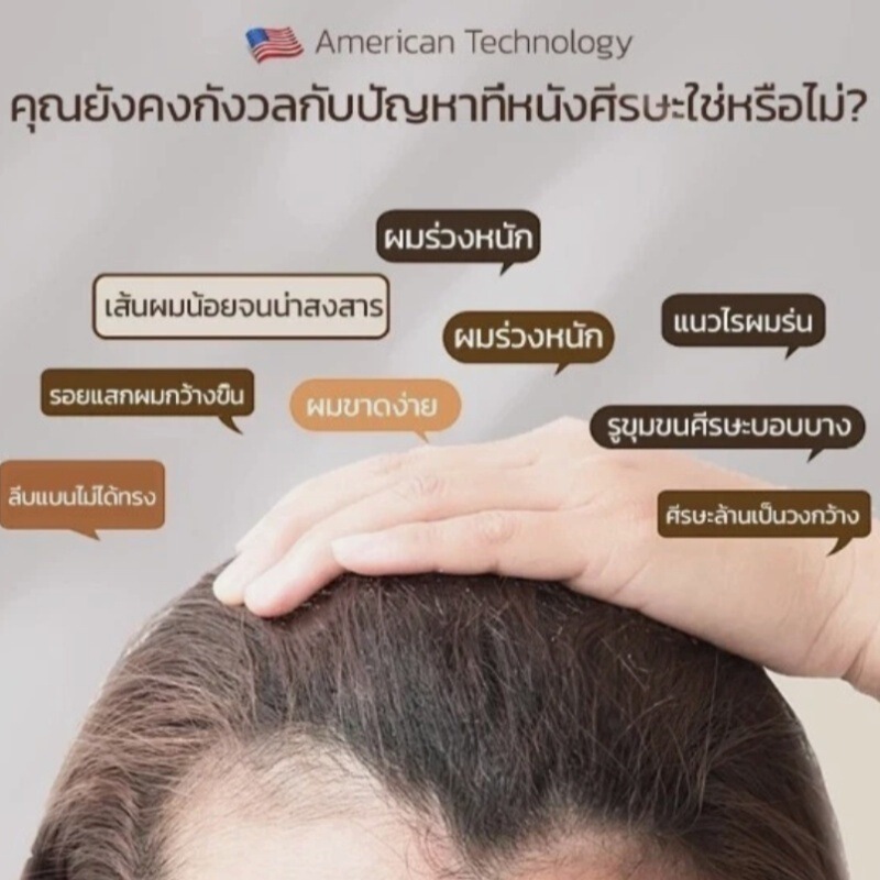 亚马逊 TK爆品   Hair Tonic Prevent Hair护发液 头发防护液|undefined