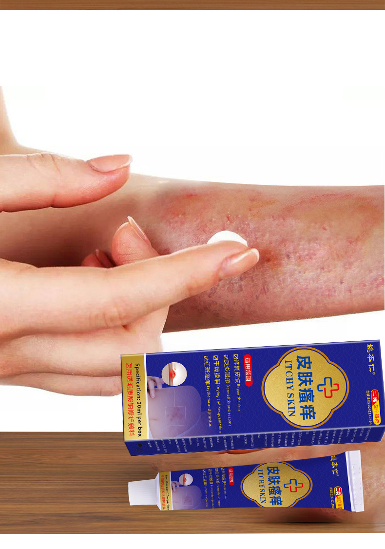 Yao Benren Skin Itch Relief Cream Class II Medical Device 20ml External Use specifications