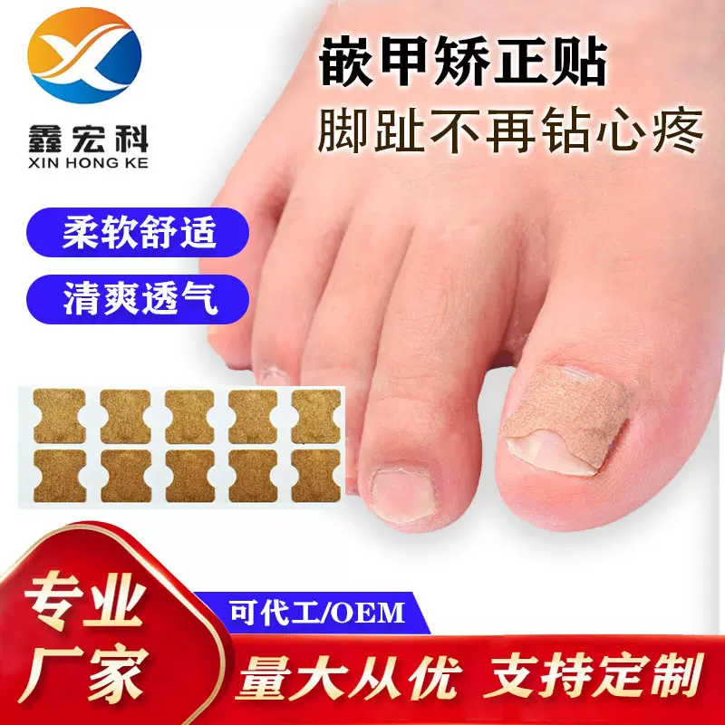 正甲贴脚趾嵌甲贴指甲贴甲沟内卷套装指甲纠正贴正甲贴护理修脚