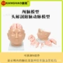 颅脑血管着色动脉模型