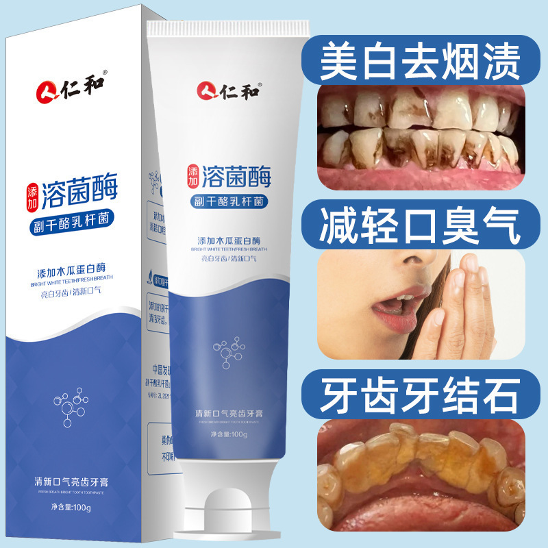 Renhe Enzyme Toothpaste genuine goods Probiotics Tooth Stains and Calculi Bad Breath White Toothpaste Fresh Breath Wholesale