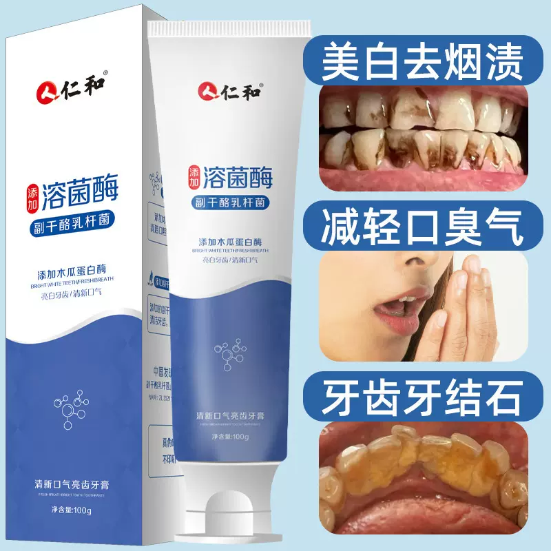 仁和酵素牙膏正品益生菌去牙渍牙结石口臭洁白牙膏清新口气批发
