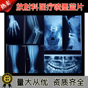 ��ī�{ɫ�t���zƬ�{����ʽ����ƴ�ӡ�zƬ���ƹ���X��Ƭ DR CR CT
