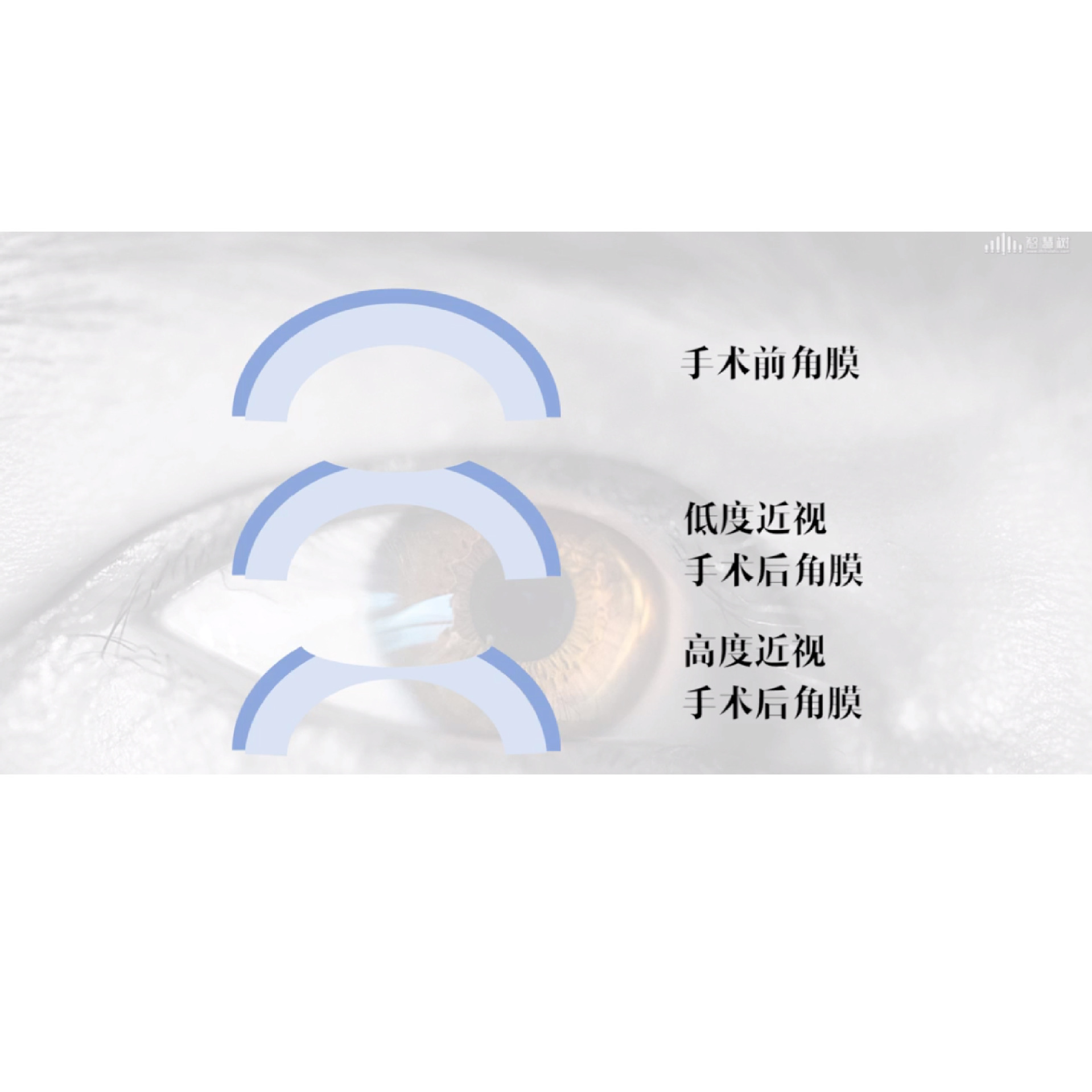 ���Ӻ������ȷ����4���������� �γ�����