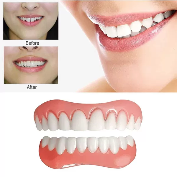 Instant Smile Silicone Artificial Teeth Braces for Upper and Lower Teeth, Smile Denture Braces