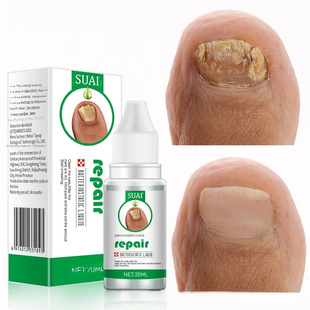 SUAI Gray armor repair liquid onychomycosis antibacterial liquid carapace deck grey armor factory direct sales