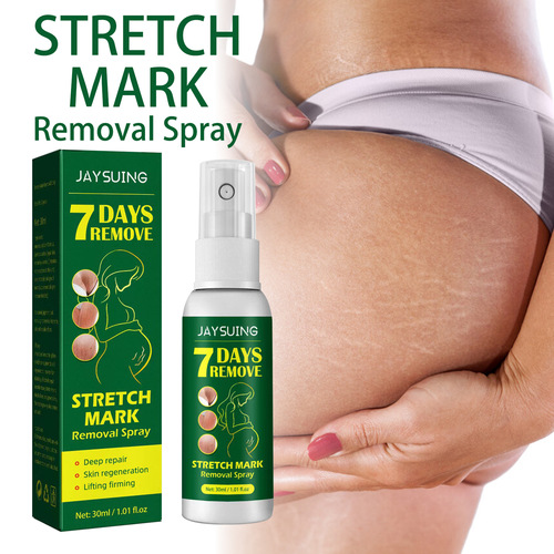 Jaysuing Pregnancy Repair Spray Fades Pregnancy Fine Marks for Pregnant Women and Postpartum Skin Stretch Marks Care Spray