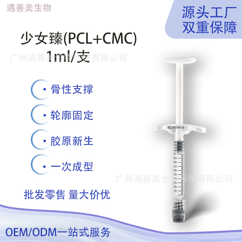 The Same Model Used by the Girl Uses Pcl+Cmc Contour Fixation for Bone Support, Preventing the Chin, Temples, and Cheeks from Collapsing